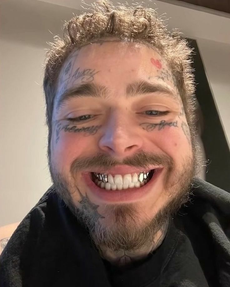 Post Malone before dental work